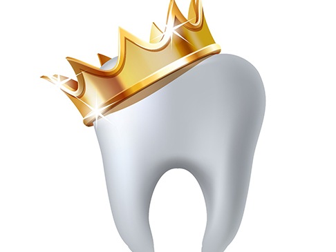 illustration of a dental crown wearing a king crown  
