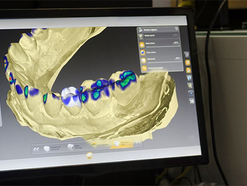 Digital dental x-rays