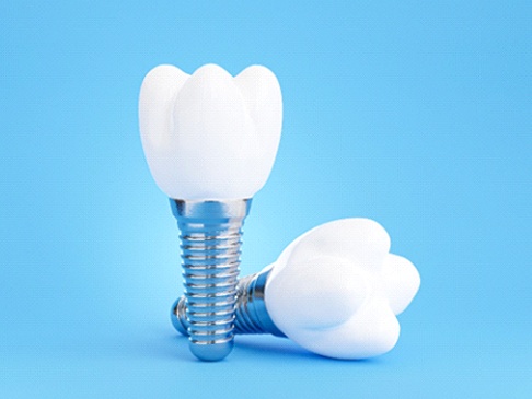 Two dental implants and crowns arranged against blue background