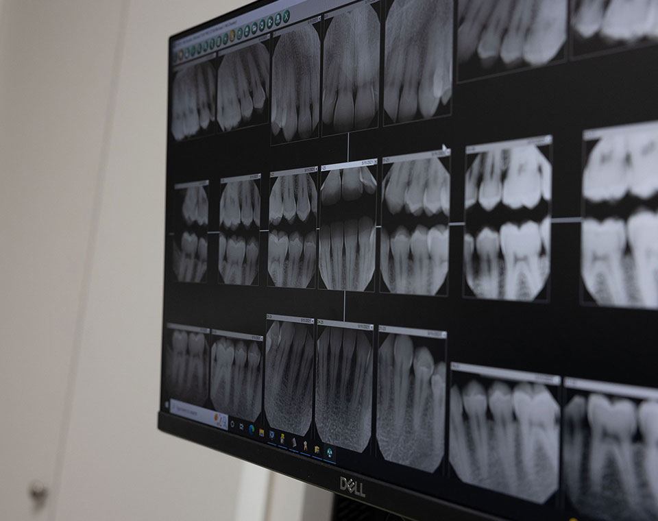 Dental team member and patient reviewing digital dental x-rays