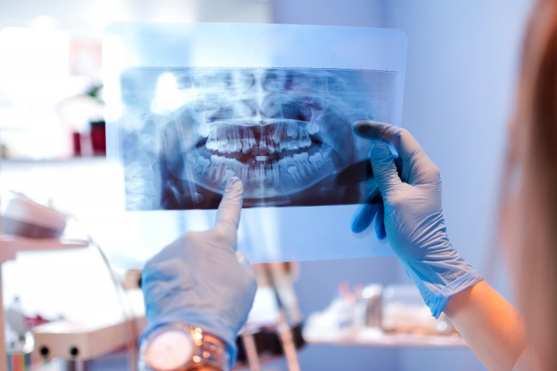 A dentist looking at an X-ray